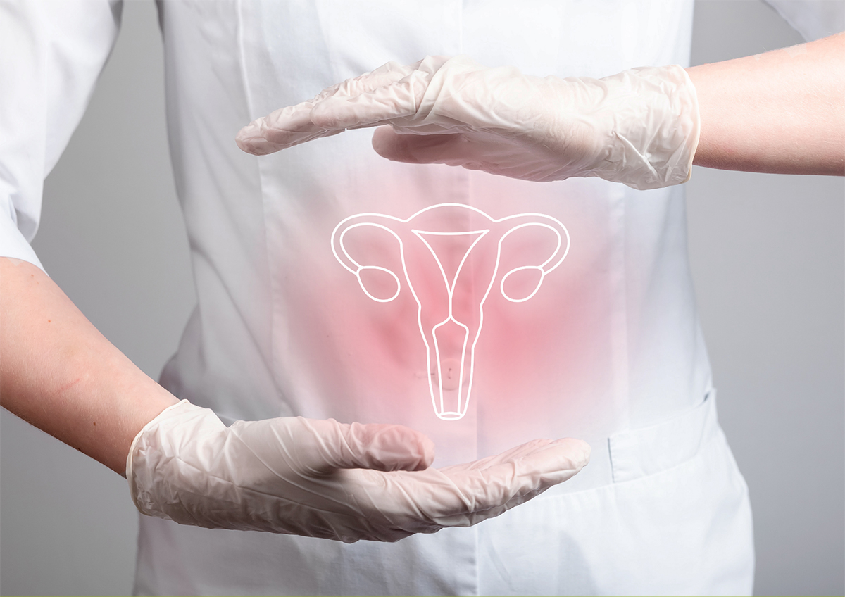 prévention du cancer de l'uterus CPTS de l'Est Lyonnais